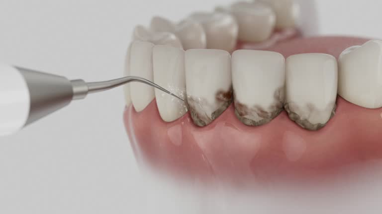 Reliable Dental Implants contractor in Dundee, MI by Smile Center Dentistry